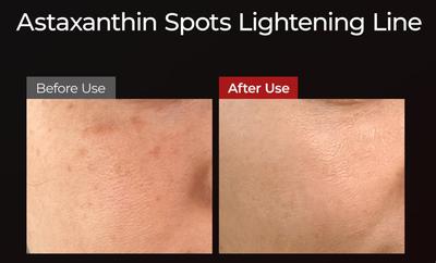 Astaxanthin Whitening Ampoule Mask