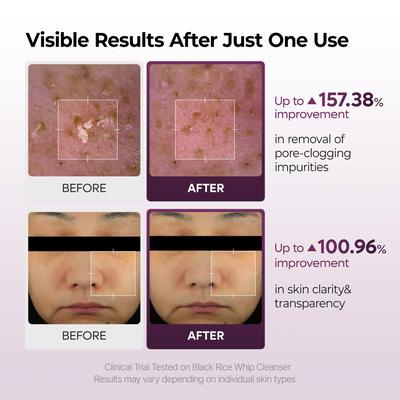 Black Rice Mochi Whip Cleanser