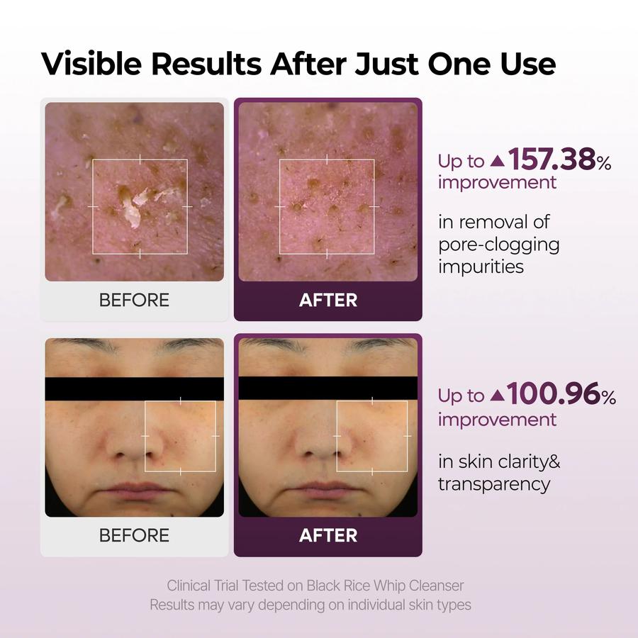 Black Rice Mochi Whip Cleanser