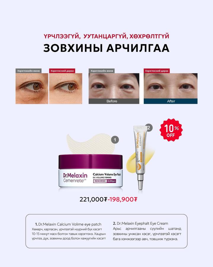 Үрчлээгүй ,уутанцаргүй, хөхрөлтгүй зовхины арчилгаа