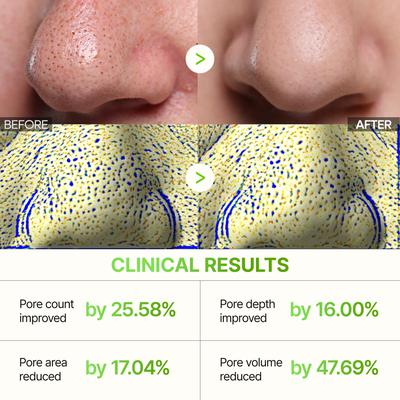 Dr.Melaxin 3 Step Nose Pore Pack