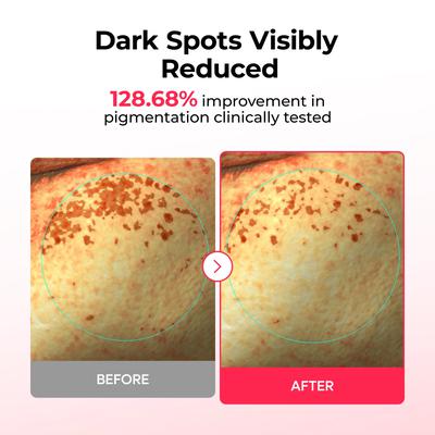 Dr.Melaxin TX Astaxanthin Dark Spot Care Hydrogel Mask