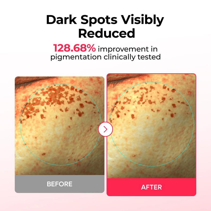 Dr.Melaxin TX Astaxanthin Dark Spot Care Hydrogel Mask