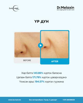 Dr.Melaxin Peel Shot Exfoliation TX Serum