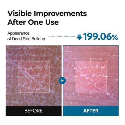 Peel Shot Exfoliating TX Spray