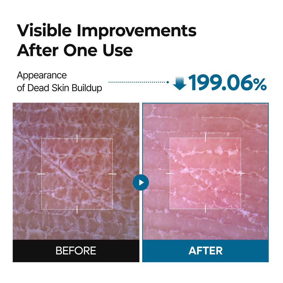 Peel Shot Exfoliating TX Spray