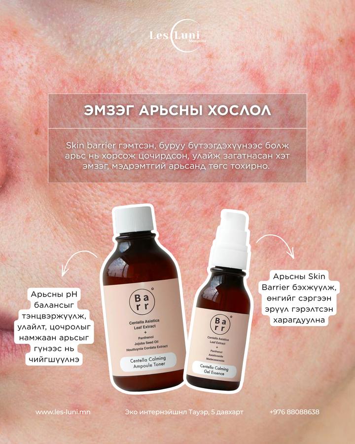 Эмзэг арьсны хослол