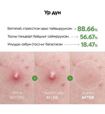 Dr.Melaxin S-Zinc Ultra Thin Acne Patch