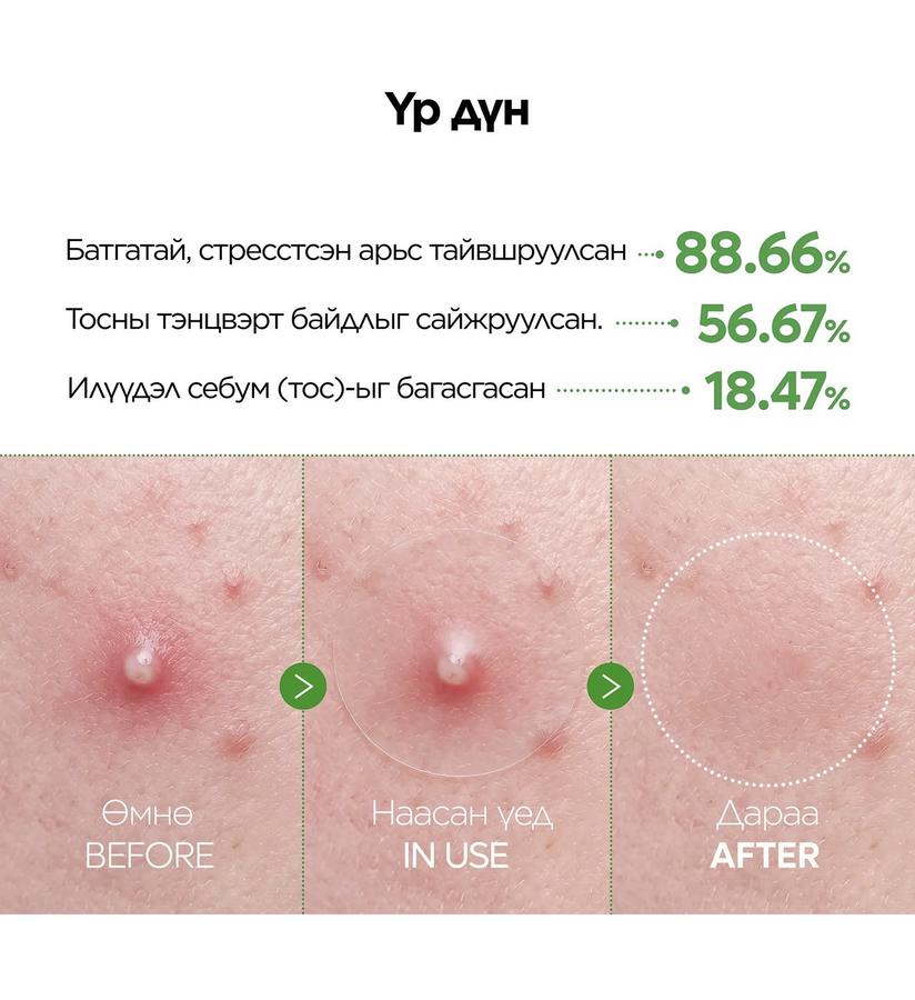 Dr.Melaxin S-Zinc Ultra Thin Acne Patch
