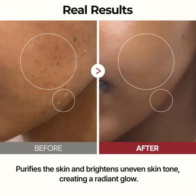 Dr.Melaxing Peeling Shot Glow Rice Toner 