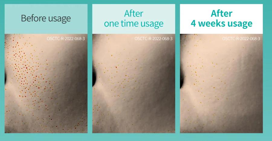 Dr.Melaxin Pore Ampoule 100ml